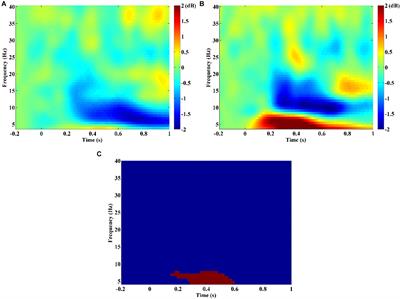 Classification of Schizophrenia by Combination of Brain Effective and Functional Connectivity